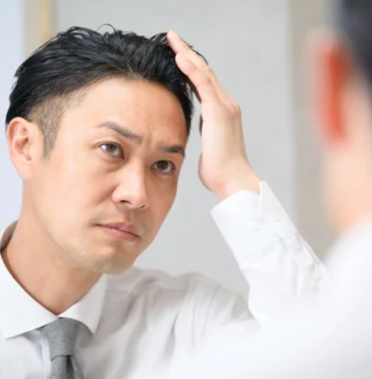 Androgenetic Alopecia Treatment