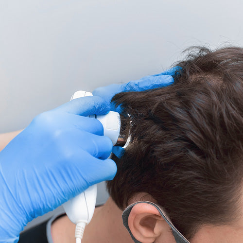 What is Hair Loss and Does it Help to Use an Anti-Hair Loss Shampoo?