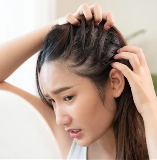 stress lifestyle hair loss young scalp